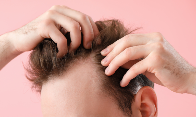 Cantor Lucas Lucco enfrenta processo após sorteio polêmico de transplante capilar 2 Cantor Lucas Lucco enfrenta processo judicial após sorteio polemico de transplante capilar